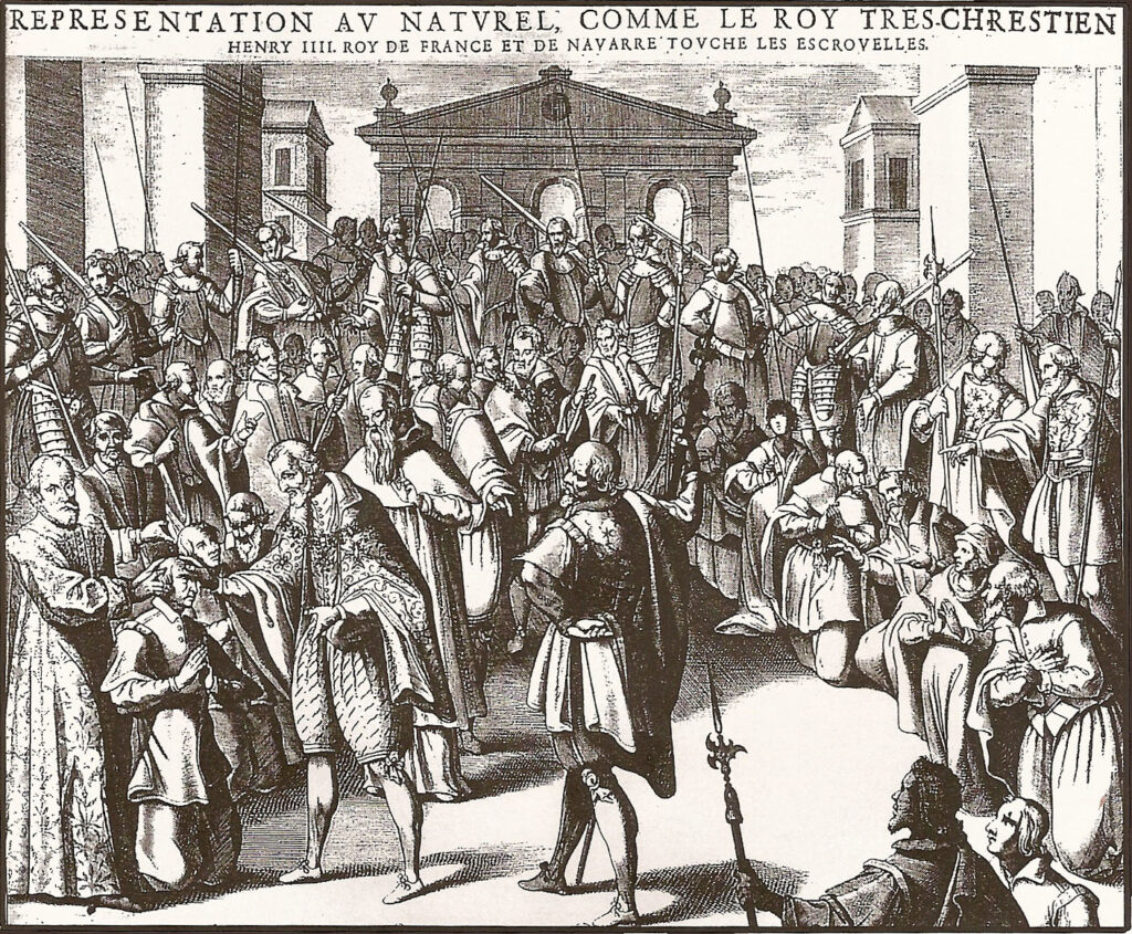Giornata mondiale della tubercolosi