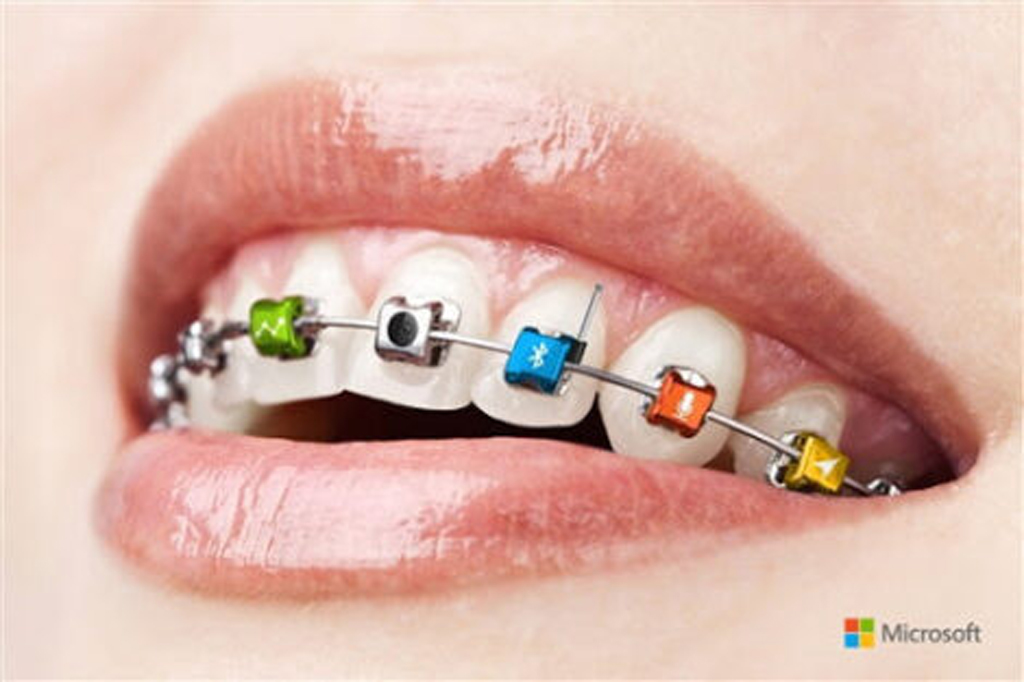 microsoft braces - alt